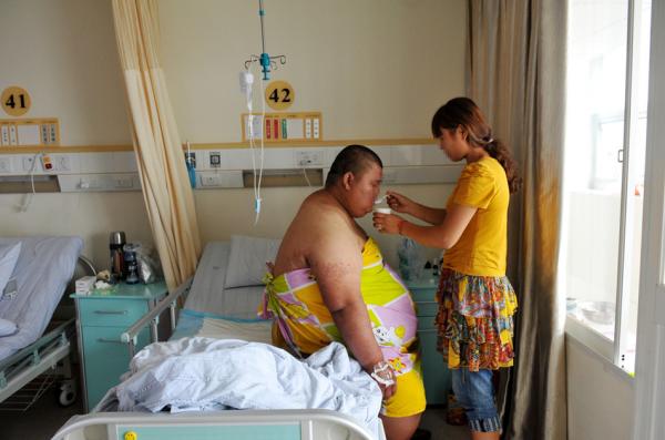 В Нанкине успешно прооперирован один из самых толстых жителей Китая