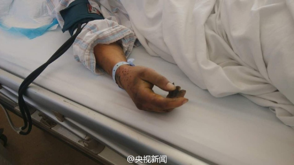 Под обломками на месте взрыва в Тяньцзине найден выживший