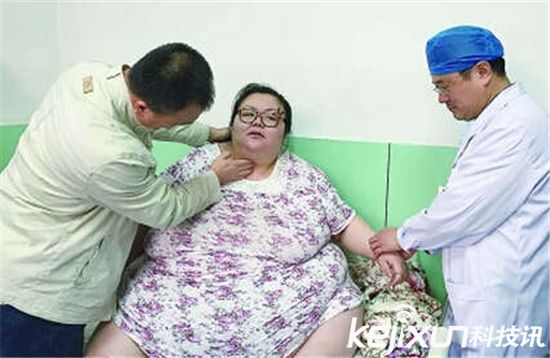 Самой тяжелой женщине в Китае сделали операцию из-за угрозы здоровью