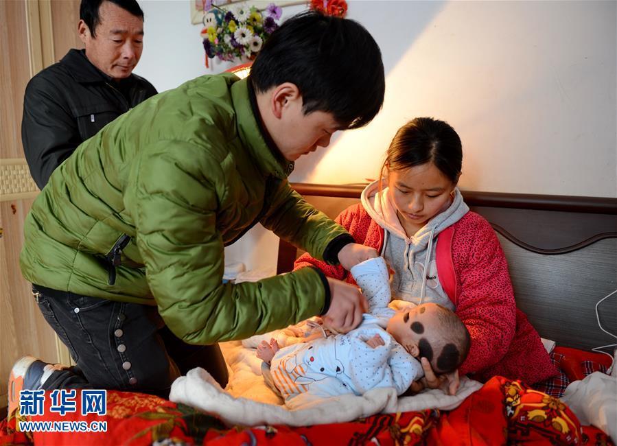 Грудная девочка в провинции Хэбэй заболела редкой кожной болезнью