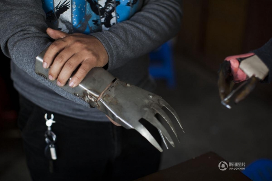 Потерявший обе руки 63-летний крестьянин уже 36 лет разрабатывает "железные руки"