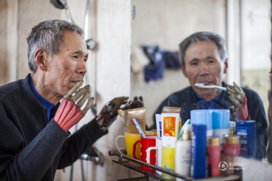 Потерявший обе руки 63-летний крестьянин уже 36 лет разрабатывает "железные руки"