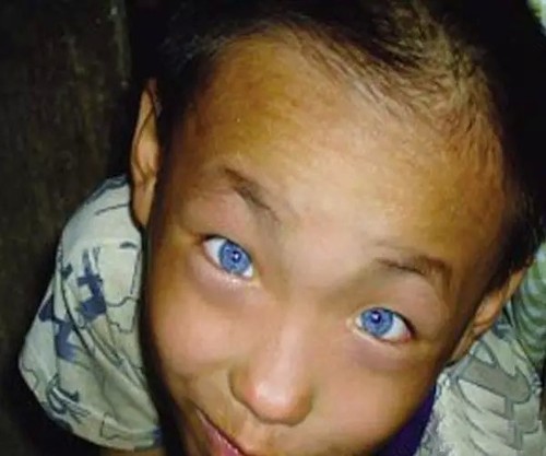 Чудо! Девятилетний китайский мальчик с голубыми глазами может видеть в темноте