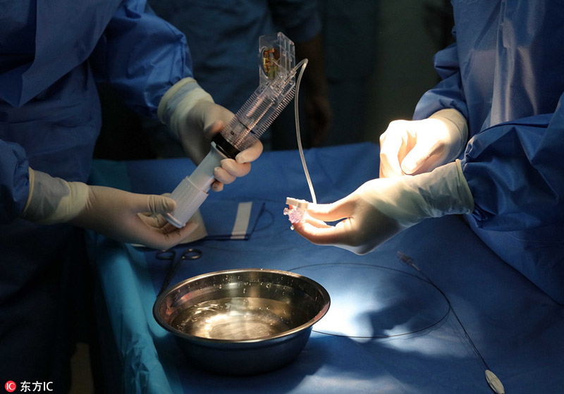 В Китае проведена первая внутриутробная операция на сердце у 28-недельного плода