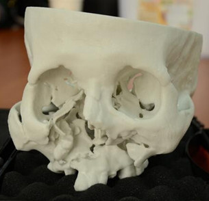 Китайские ученые напечатали на 3D-биопринтере "живую" искусственную кость