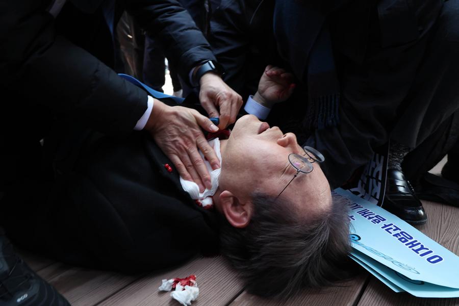  Лидер ведущей оппозиционной партии РК подвергся нападению и доставлен в больницу 