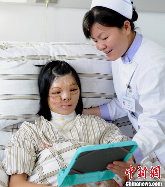 В провинции Фуцзянь успешно прошла первая операция по изменению черт лица  (4)