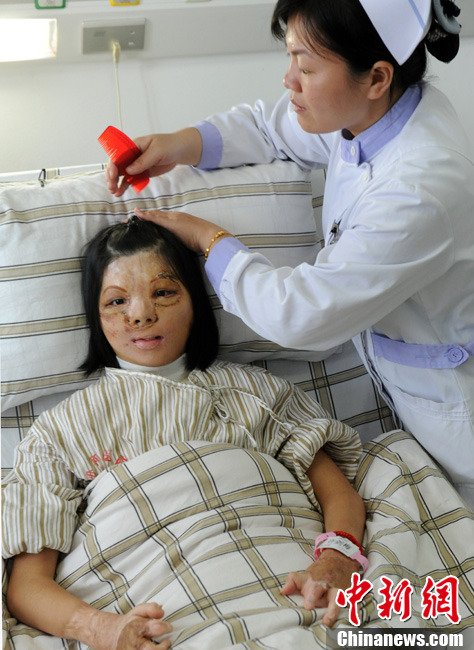 В провинции Фуцзянь успешно прошла первая операция по изменению черт лица 