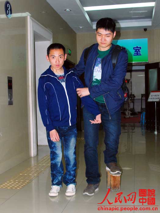 У мужчины из провинции Ляонин разница в длине ног составляет 23 см (2)